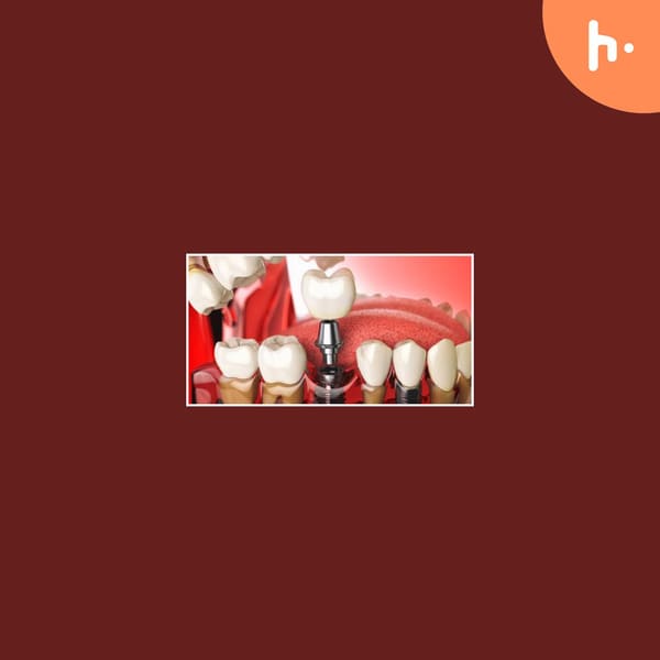 Cover art for Top 5 Nutrition Tips After Dental Implants in Washington